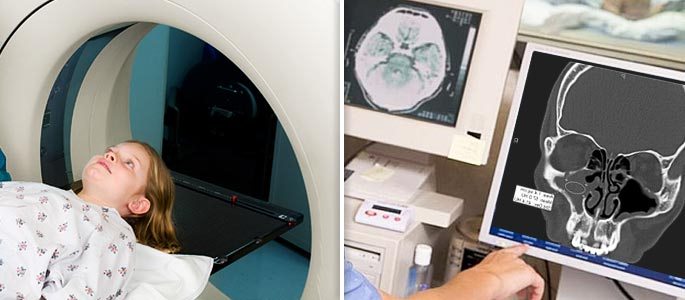 Ребенку проводится компьютерная томография пазух