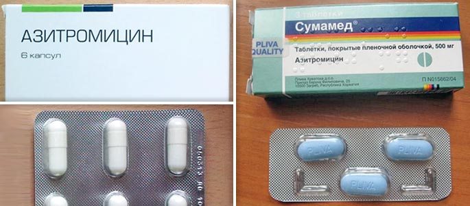 Таблетки азитромицин и сумамед