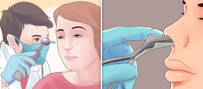 Визуальный осмотр врачом полостей носа и уха