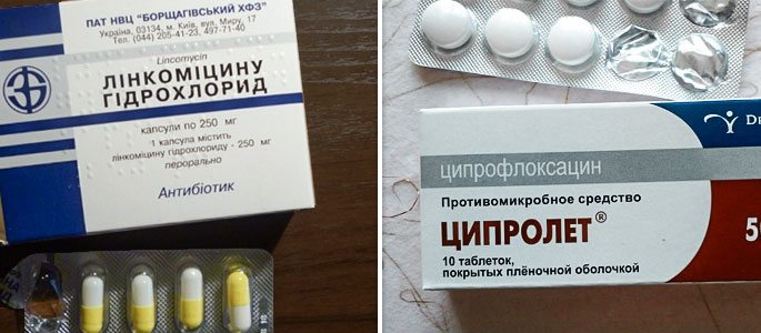 Антибиотики Ципролет и Линкомицин