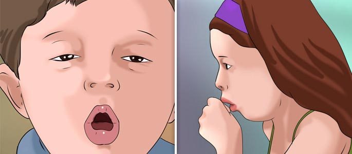 Отхаркивающийся кашель у ребенка